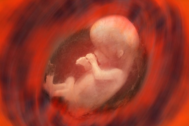 Dead Fetus – Dream Meaning and Symbolism 1